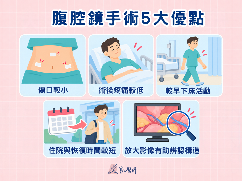 腹腔鏡手術優點圖卡,說明傷口通常較小、疼痛可能較低、較早下床活動、恢復時間可能縮短及放大影像的作用